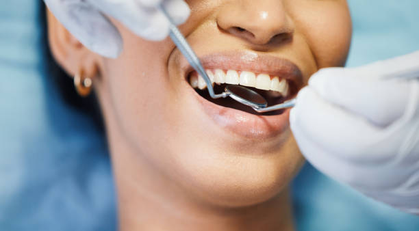 Best Pediatric Emergency Dentist in Bell Nyon, CA